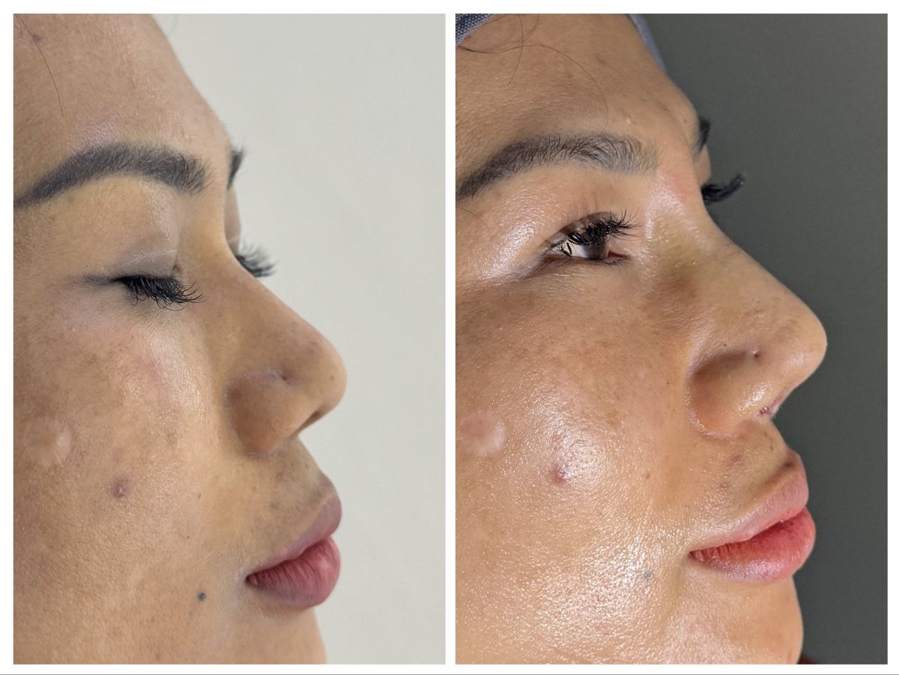 Treatment Result 1