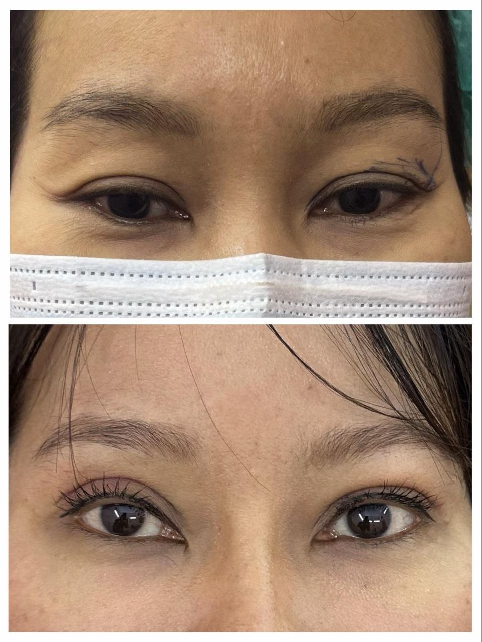 Treatment Result 3