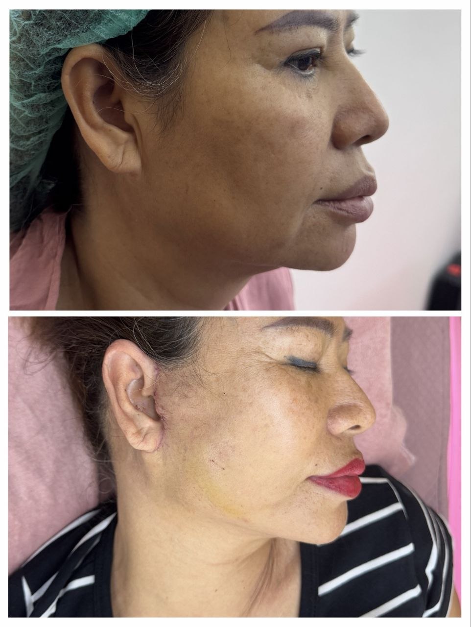 Treatment Result 5