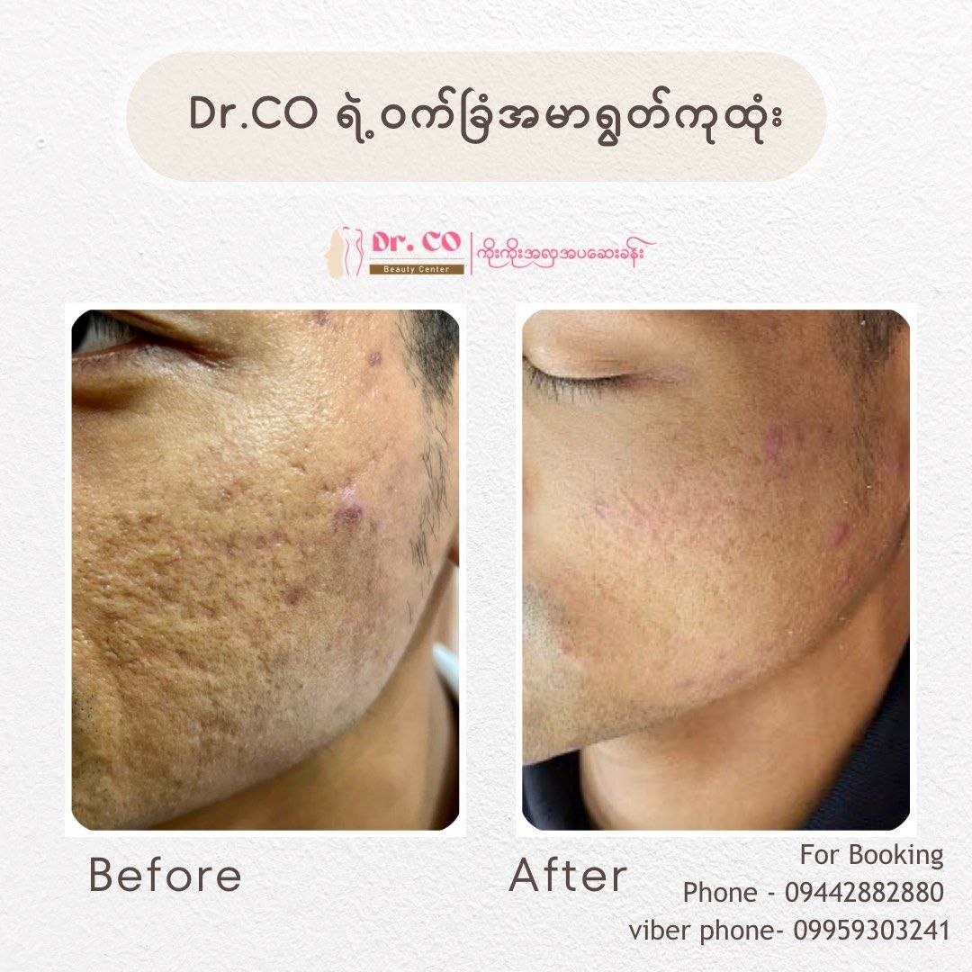 Treatment Result 6