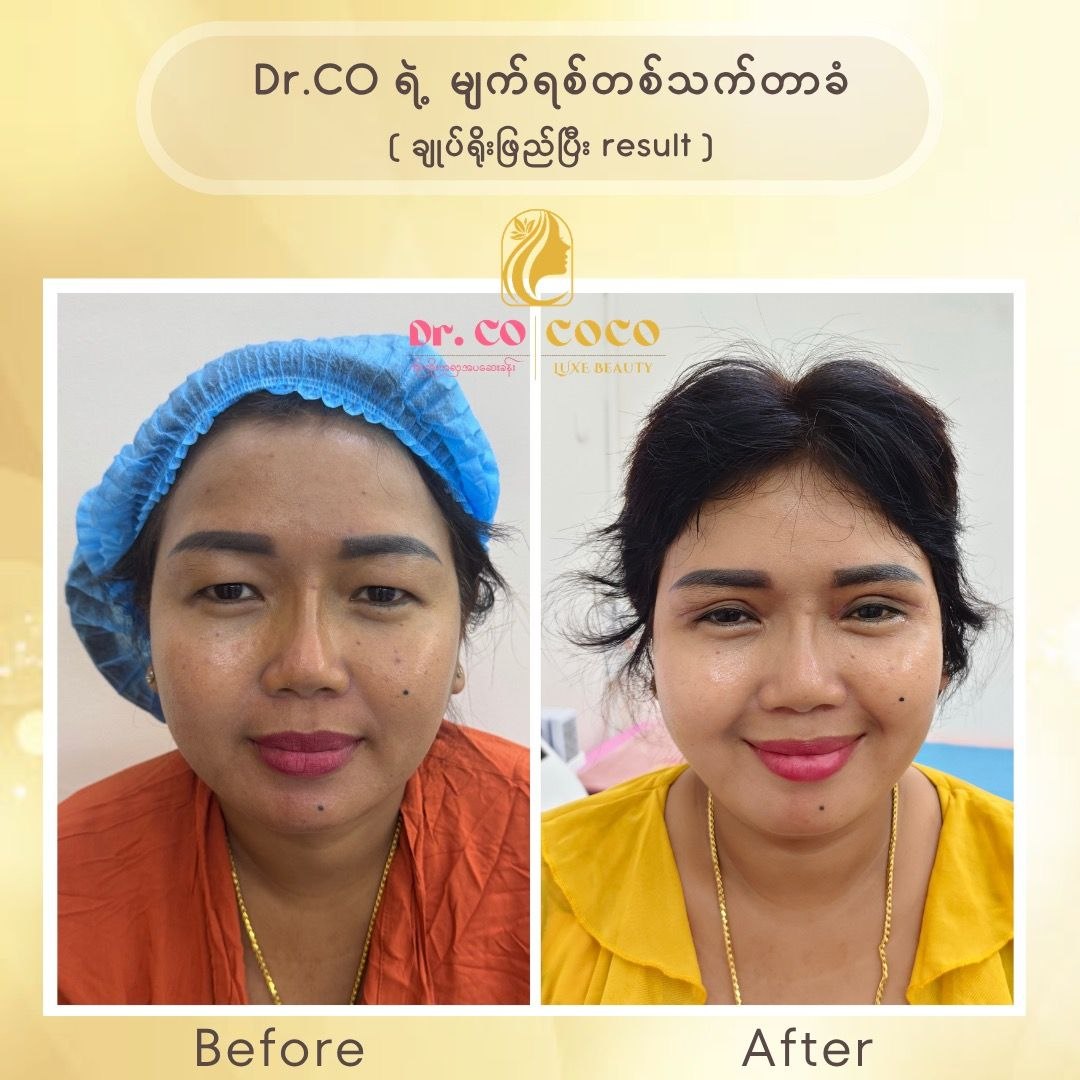 Treatment Result 8
